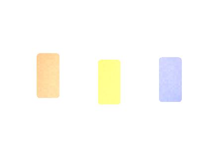 Esco Bars Esco 5 Incoterms Comparison for Buyers for Bulk Buyers